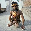 Next picture :: Disfigured Pakistani